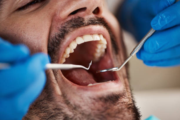 Best Broken or Chipped Tooth Repair in Sullivan, IN