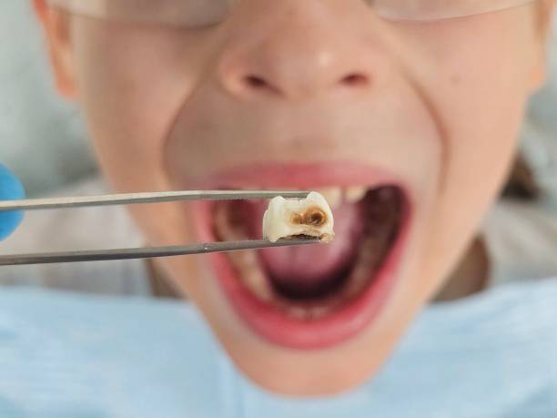 Trusted IN Emergency Dental Service Experts